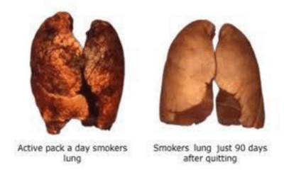 Lung Replenishment