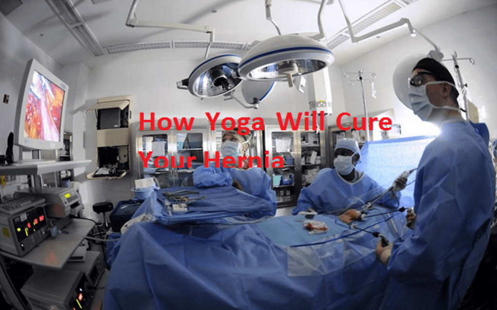 How Yoga Will Cure Your Hernia
