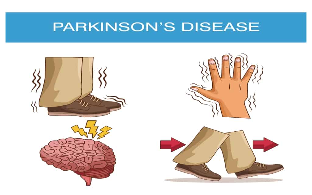 Parkinson symptoms