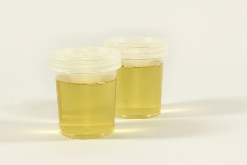 Artificial Urine Recipe 1